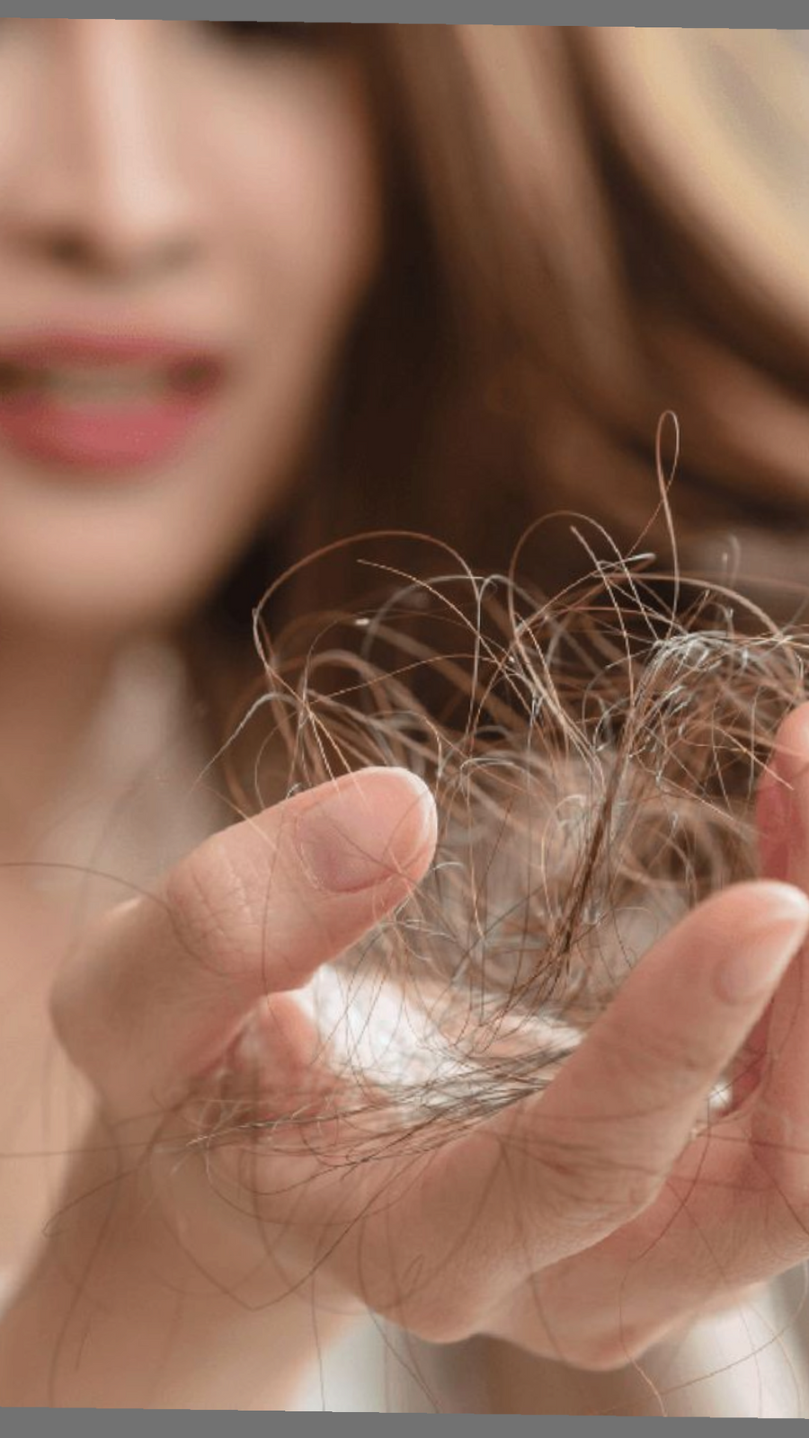 Postpartum hair fall is real–but so is recovery.