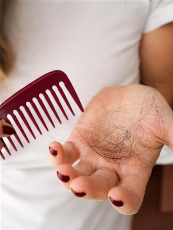 Seasonal Hair Loss